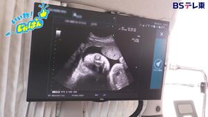 高性能エコーの導入の写真